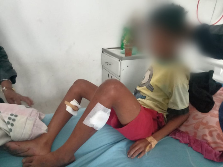 Sebuah insiden mengguncang Kota Ruteng, Kabupaten Manggarai, Nusa Tenggara Timur (NTT), di mana Yohanes Riko Putra Tion, seorang siswa kelas VI SD berusia 13 tahun, menjadi korban luka di bagian betis akibat tembakan senapan angin. Sabtu (9/12/2023).