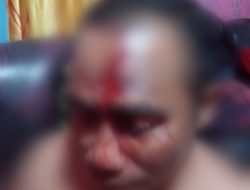 Insiden Kekerasan di Manggarai barat, Ini Kesaksian Langsung dari Korban