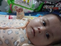 Bayi Bocor Jantung Asal Manggarai Ini Selamat Berkat Uluran Tangan