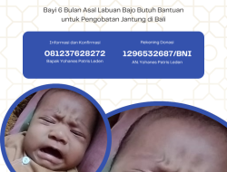 Bayi Enam Bulan di Labuan Bajo Derita Kelainan Jantung, Butuh Uluran Tangan Dermawan